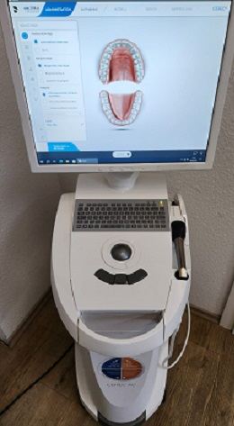 CEREC-Aufnahme eines Zahns am Bildschirm